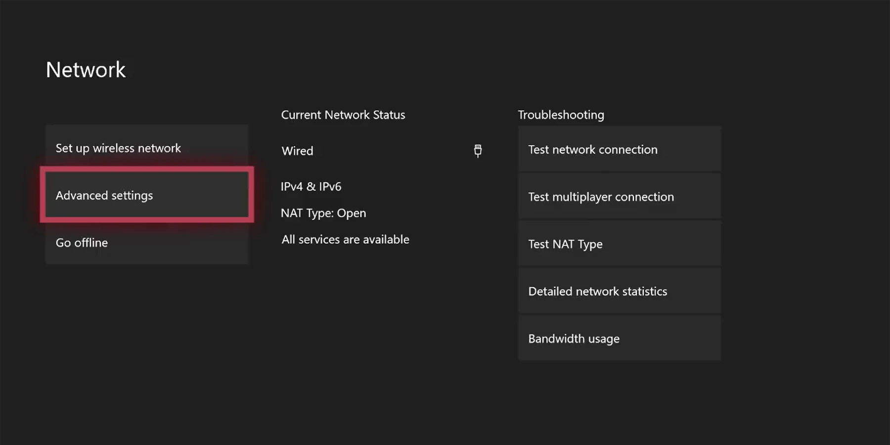 نحوه وارد کردن DNS در Xbox One