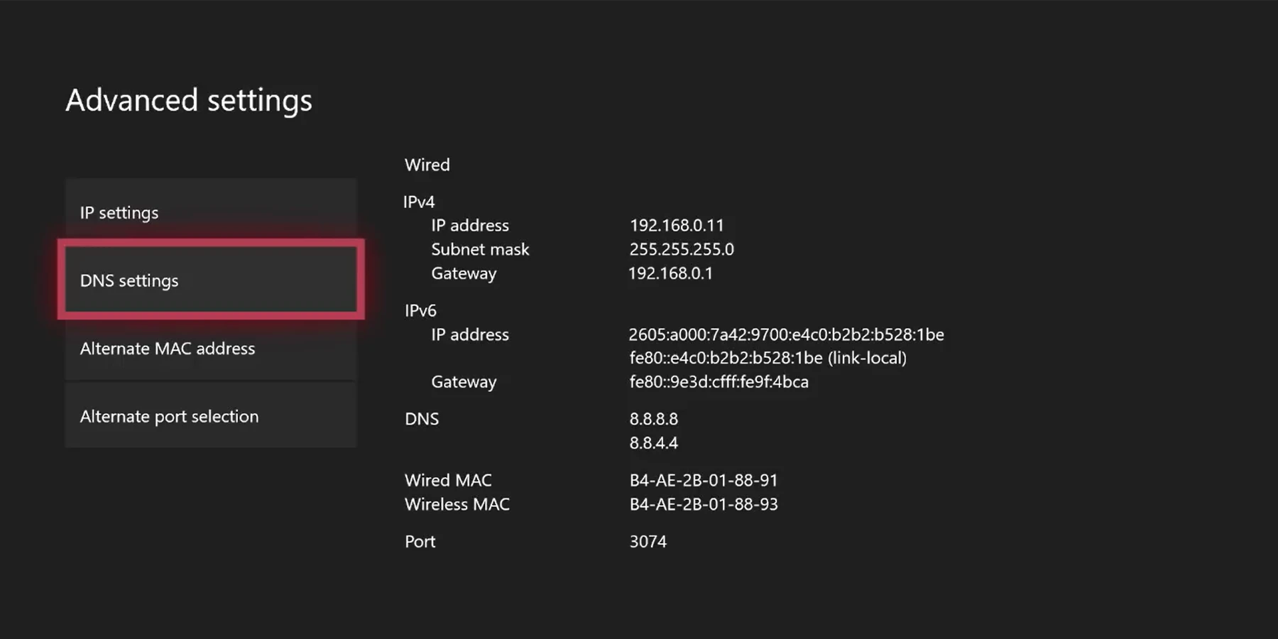 نحوه وارد کردن DNS در Xbox One